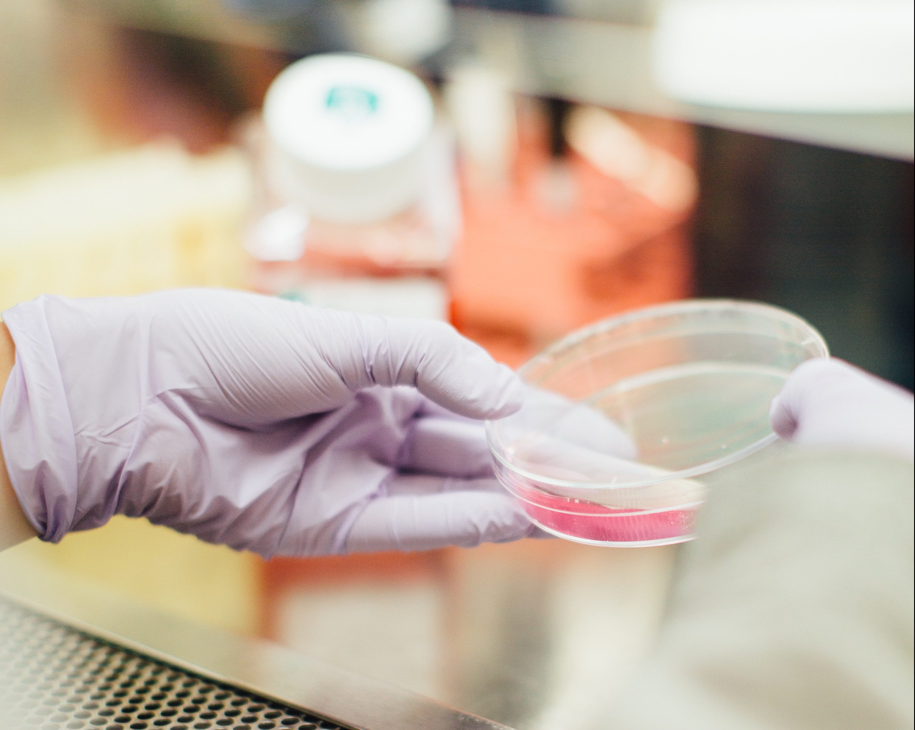 Skin Bleaching in South Africa Kaya News' Lindi Sirame Reports