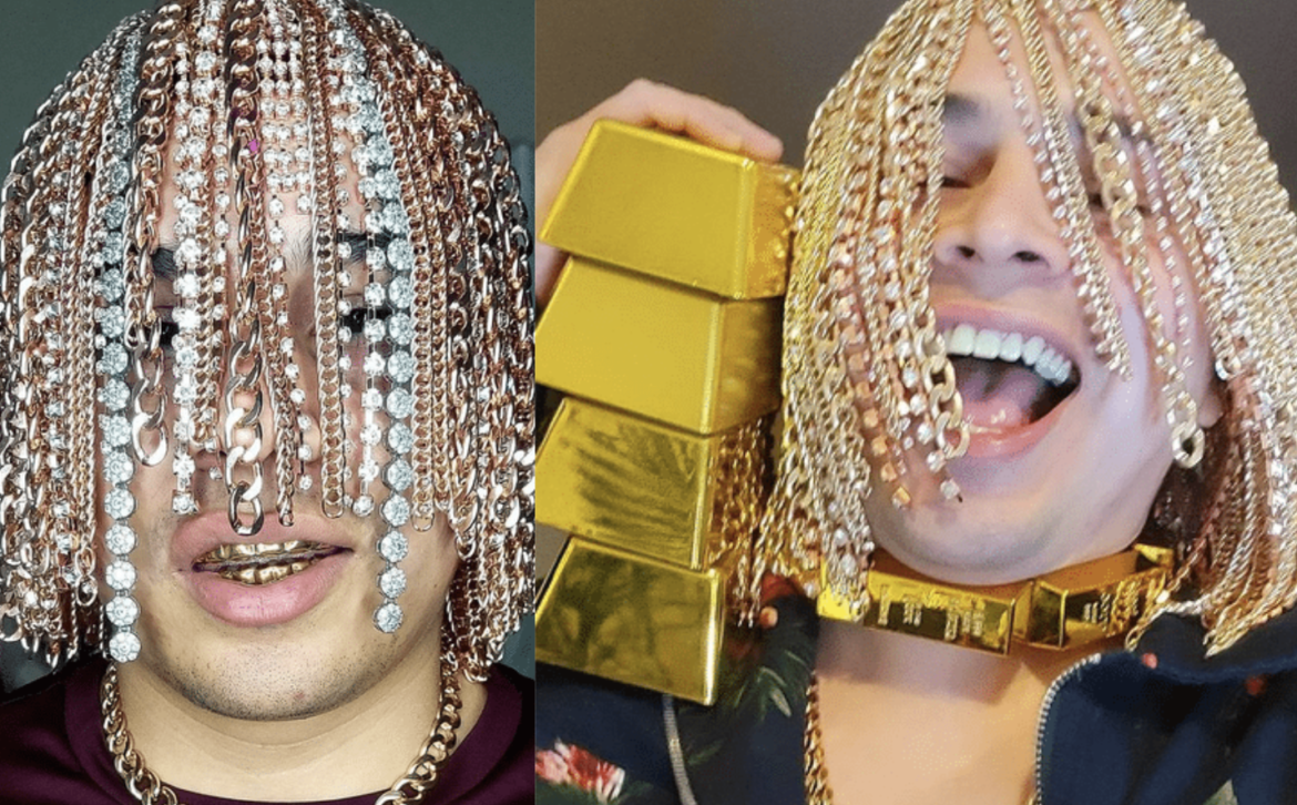 Rapper Dan Sur gets gold chains surgically implanted into his head