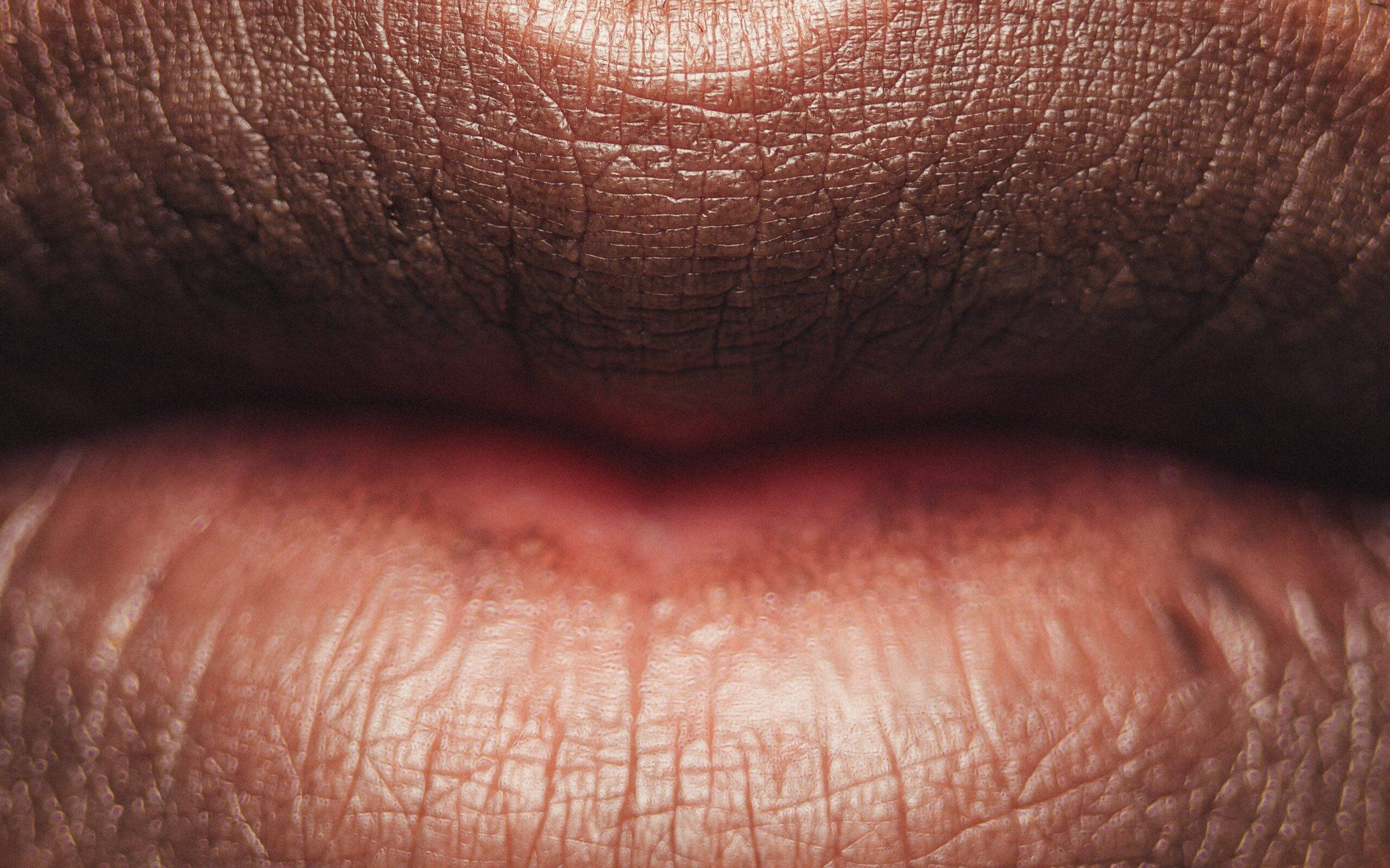 Pucker up! Tips to keep your lips from chapping