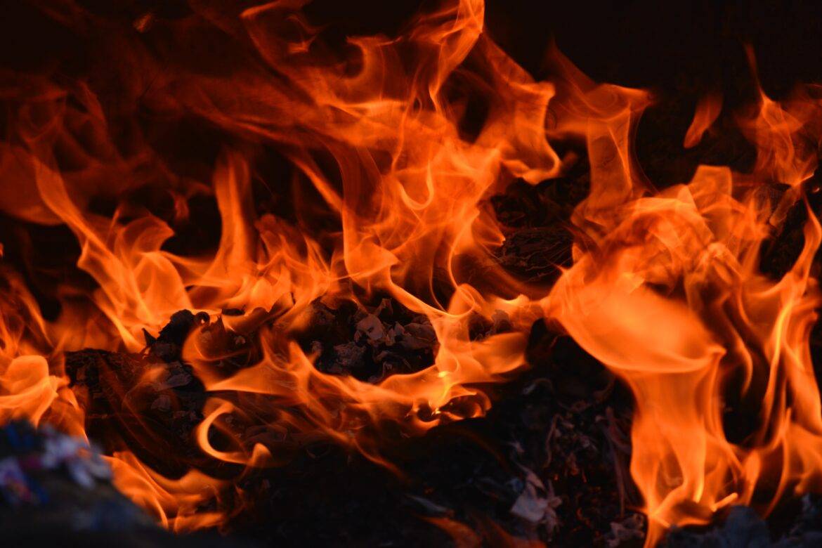 Sister of former Banyana star burnt beyond recognition by boyfriend
