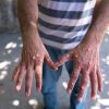 South Africans urged to remain vigilant as mpox cases rise
