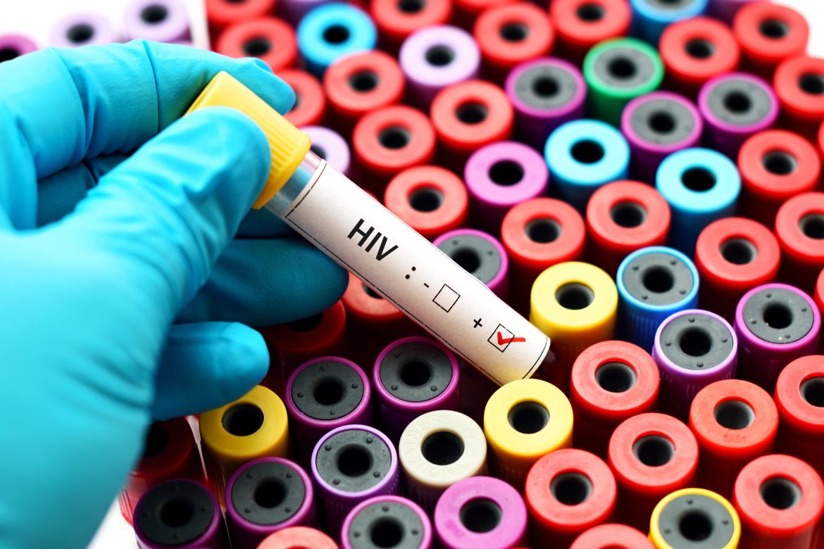 infecting partner with HIV