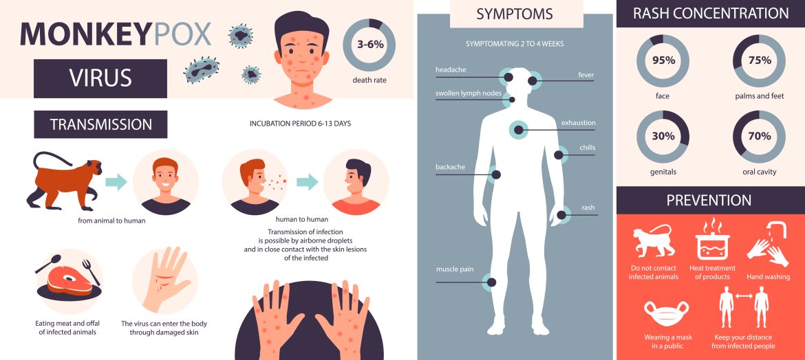 Monkeypox infographic