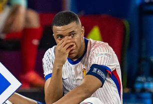 Mbappe breaks nose