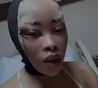 New face who dis? Khanyi gets facelift