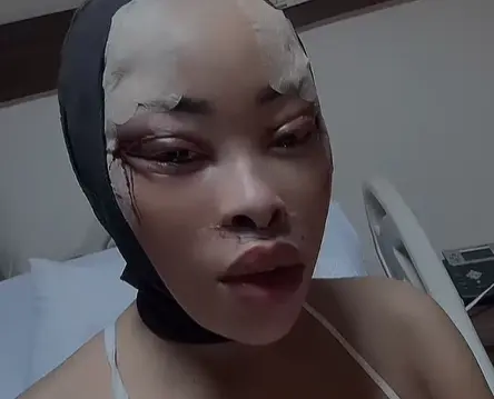 New face who dis? Khanyi gets facelift