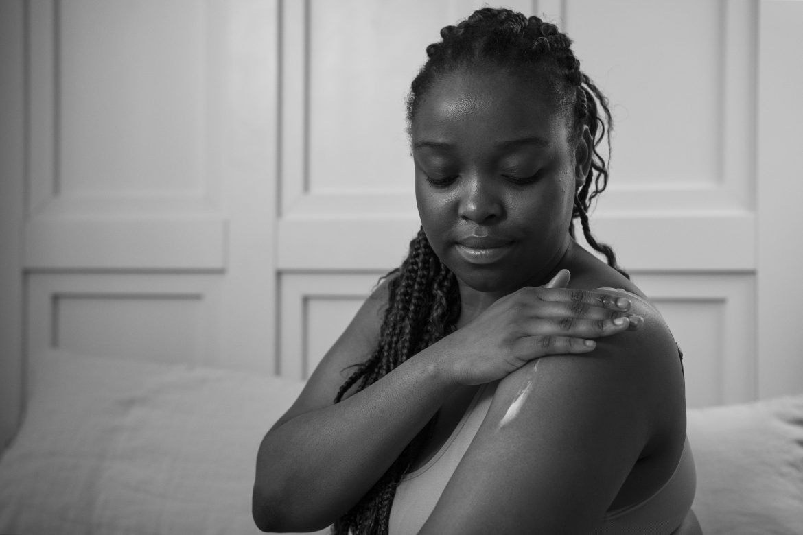 Did childhood teasing build tough skin in you or leave scars?