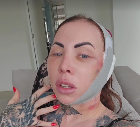 Real Housewives of Durban star Jojo Robinson gets a facelift