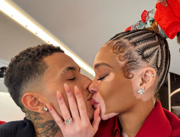 Winnie Harlow kissing her fiance Kyle Kuzma