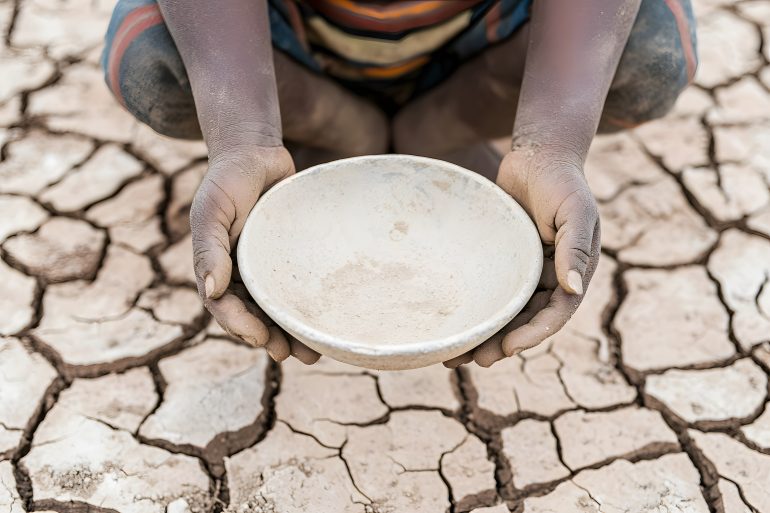 57 children reported dead from malnutrition, says WHO