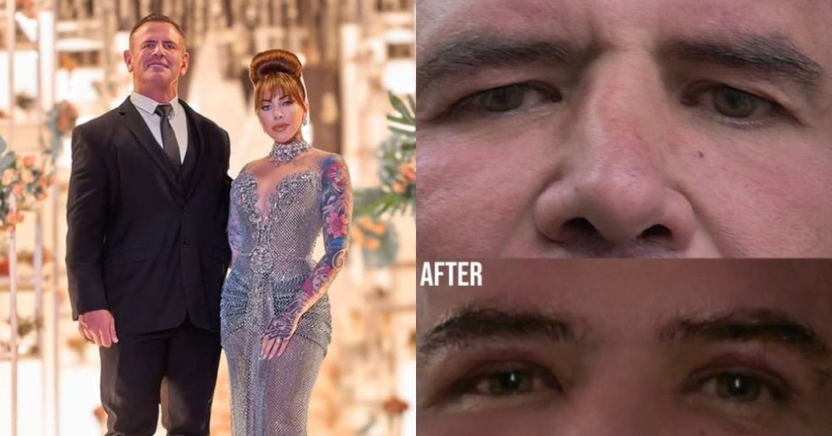 ‘I did not ask for this surgery’ – Jojo reveals reason behind Calven’s procedure