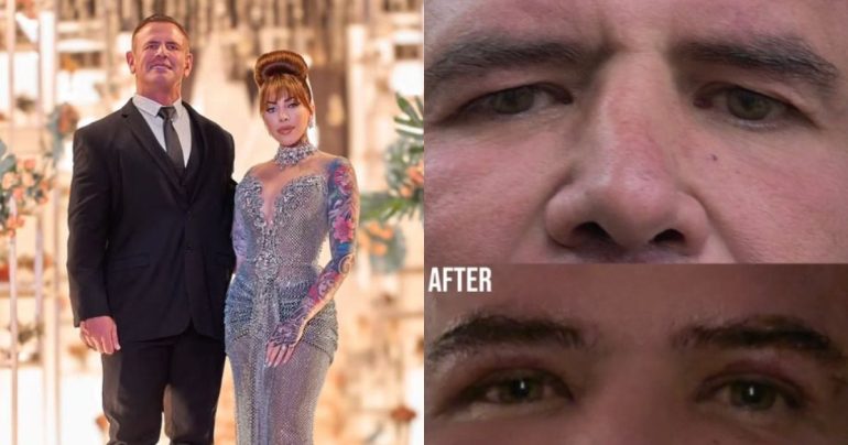 ‘I did not ask for this surgery’ – Jojo reveals reason behind Calven’s procedure