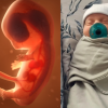 Miracle baby has been born from a 30-year-old frozen embryo