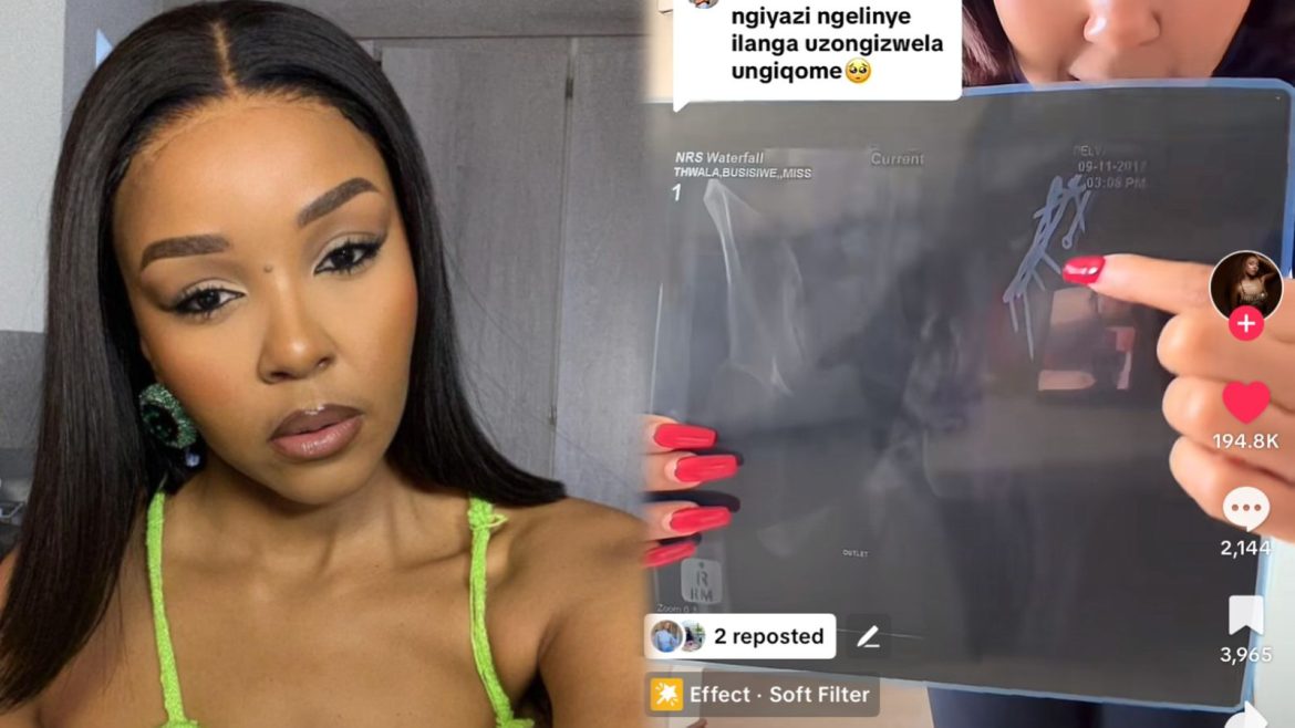 Cici reveals she has screws in her body after surviving abuse: 'I gave someone a chance and he almost killed me'