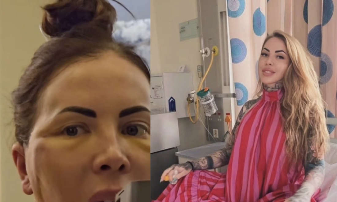 Jojo Robinson reveals plans for another cosmetic procedure