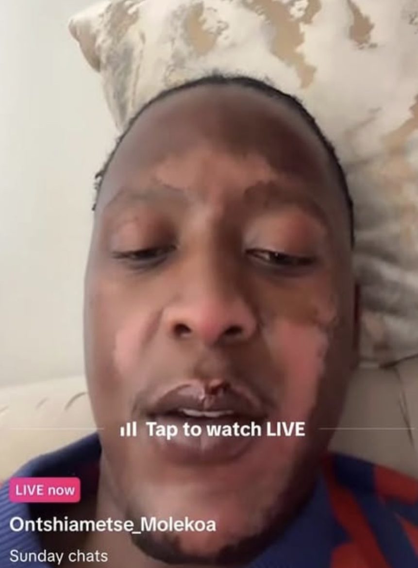 The River star Ontshiametse Molekoa suffers burn injuries in cooking accident