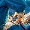 Gauteng academic hospitals give over 150 patients a second chance at life