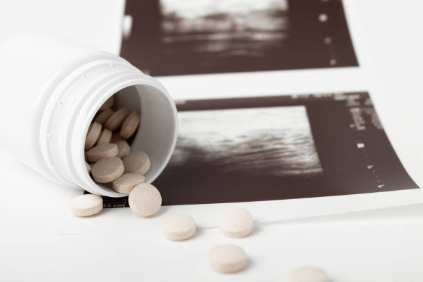 Woman sues two North West doctors for over R2 million after abortion complications